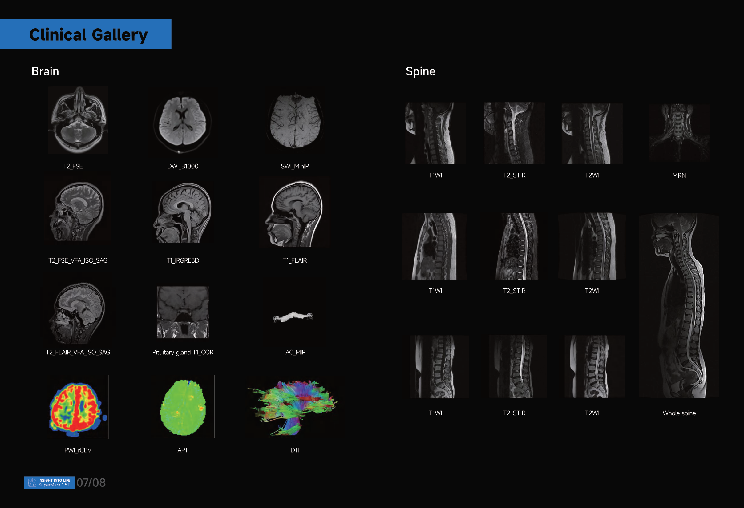 Clinical MRI Imaging